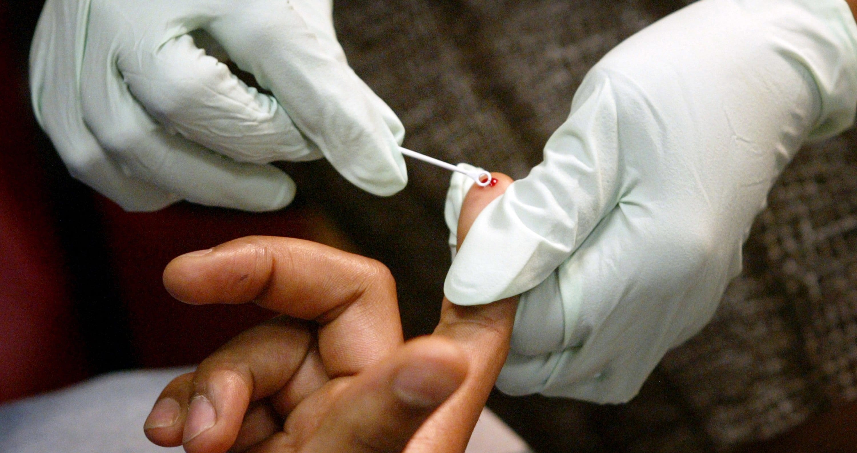 Free HIV testing in Limerick as virus on increase