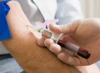 Blood test sample