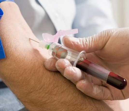 Blood test sample