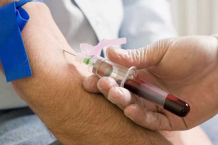 Blood test sample Blood test sample