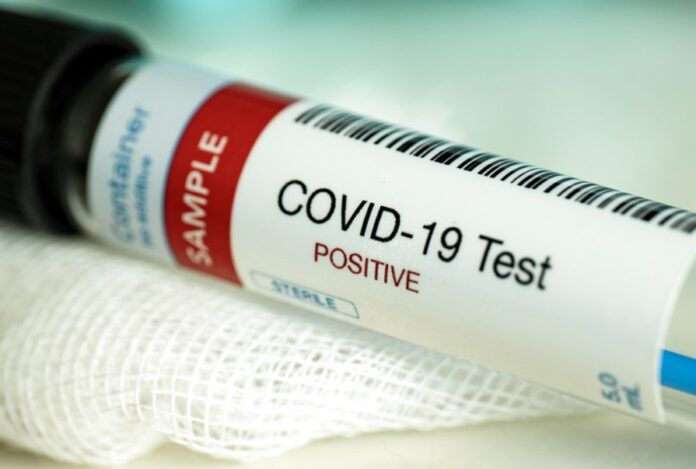 Covid Test