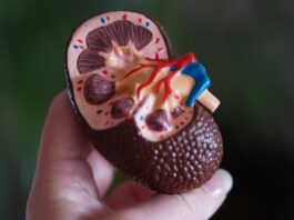 brown kidney decor