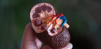 brown kidney decor