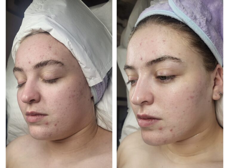 Saving face with some special treatment from High Care Health and Beauty Studio