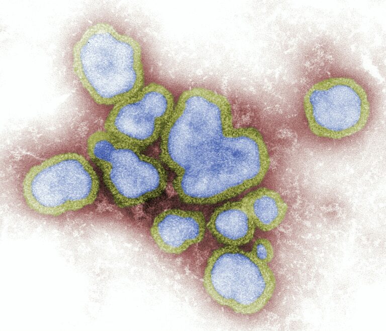 Four-fold hike in flu cases in Mid West