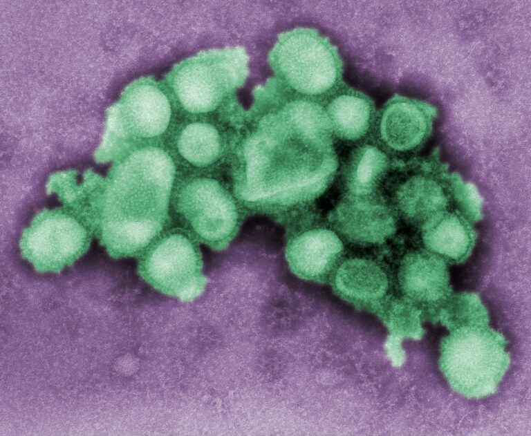 More than 800 cases of flu recorded in Mid West